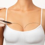 Doğal Görünümlü Meme Büyütme Nasıl Yapılır?