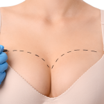 Kas Altı ve Kas Üstü Protez Arasındaki Farklar